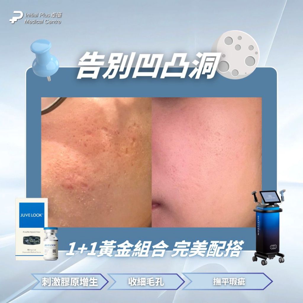 Initial Plus Medical Centre 卓優醫療診所 Morpheus 8 x Juvelook對比圖