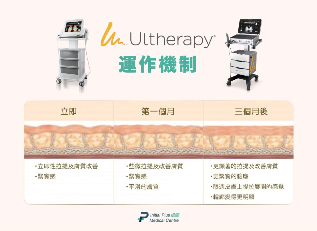 Initial Plus Medical Centre 卓優醫療診所 ultherapy與ultherapy prime 運作機制