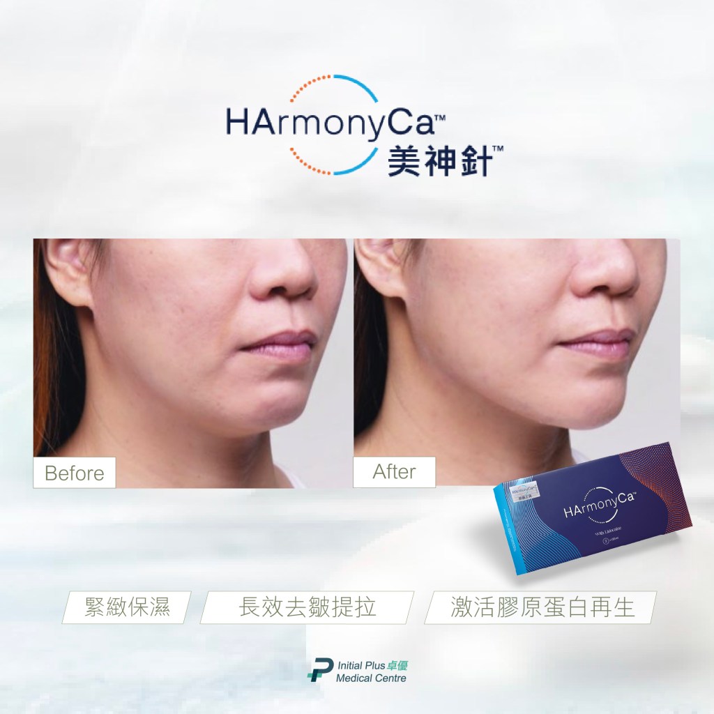 Initial Plus Medical Centre 卓優醫療診所 HArmonyCa 美神針對比圖