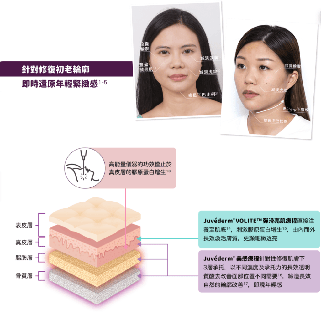 Initial Plus Medical Centre 卓優醫療診所 Juvederm 3