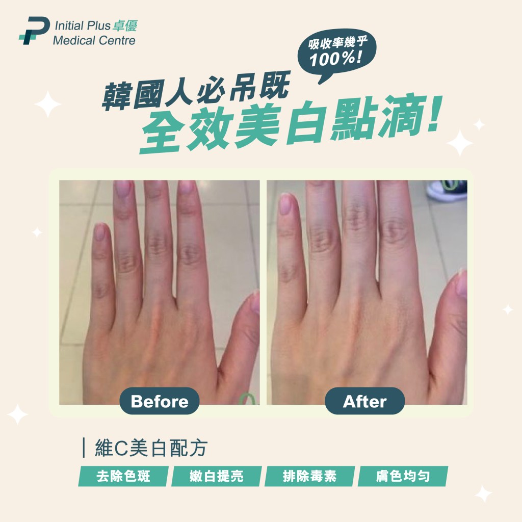 Initial Plus Medical Centre 卓優醫療診所 LV1維C美白配方對比圖2