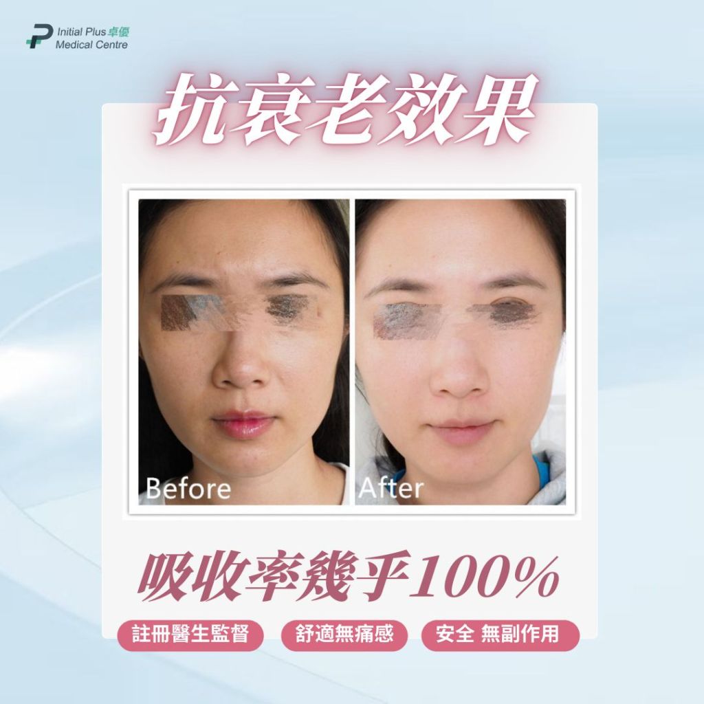 Initial Plus Medical Centre 卓優醫療診所 NAD抗衰老逆齡點滴對比圖