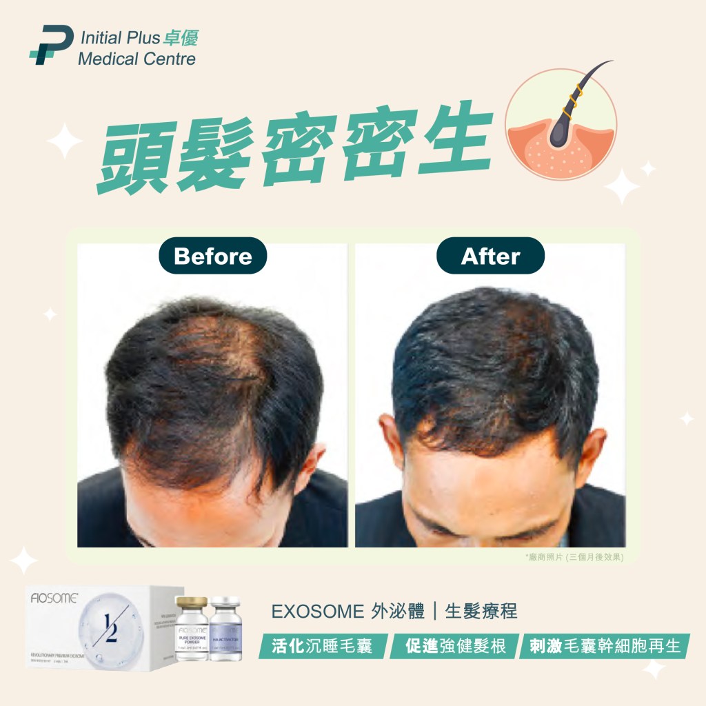 Initial Plus Medical Centre 卓優醫療診所 fiosome外泌體對比圖