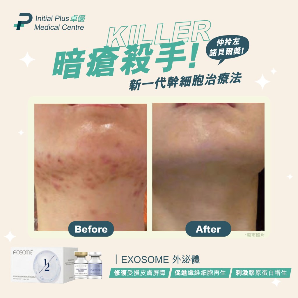 Initial Plus Medical Centre 卓優醫療診所 fiosome外泌體對比圖2