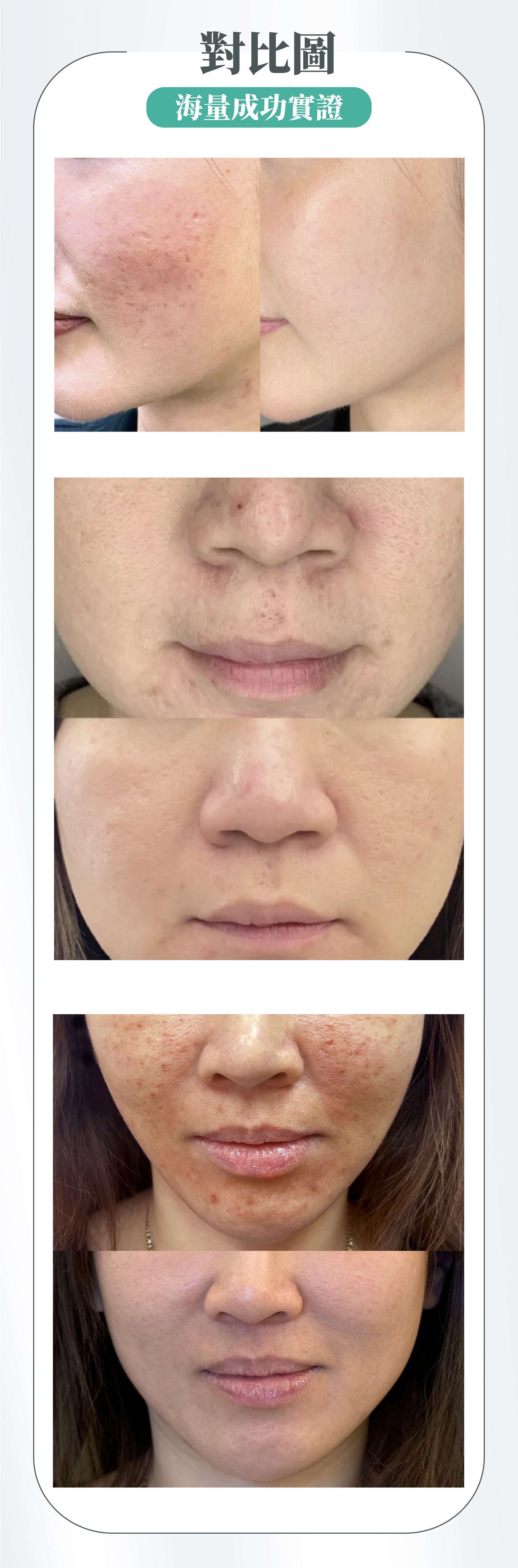 Initial Plus Medical Centre 卓優醫療診所 juvelook對比圖