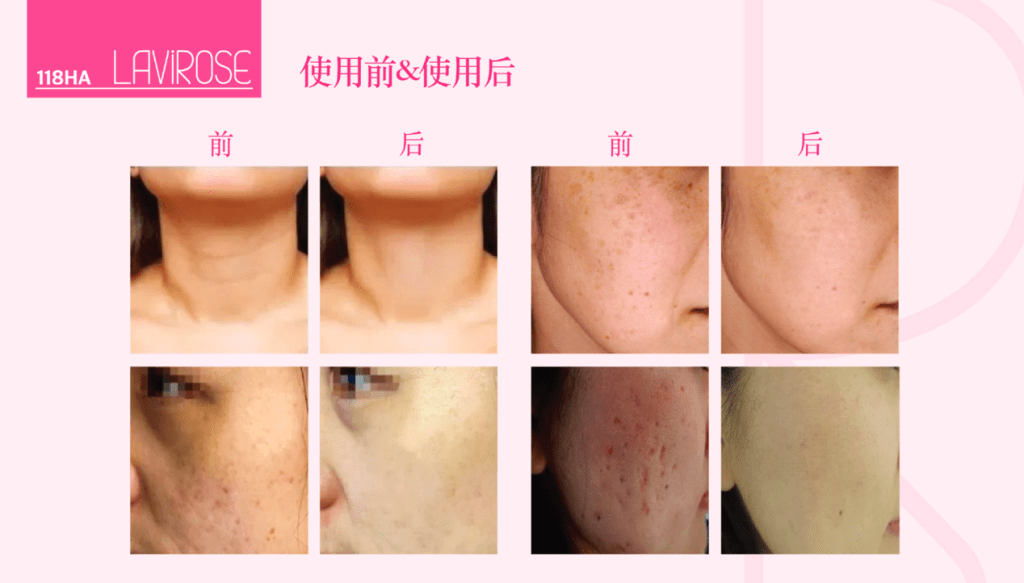 Initial Plus Medical Centre 卓優醫療診所 lavirose對比圖 3