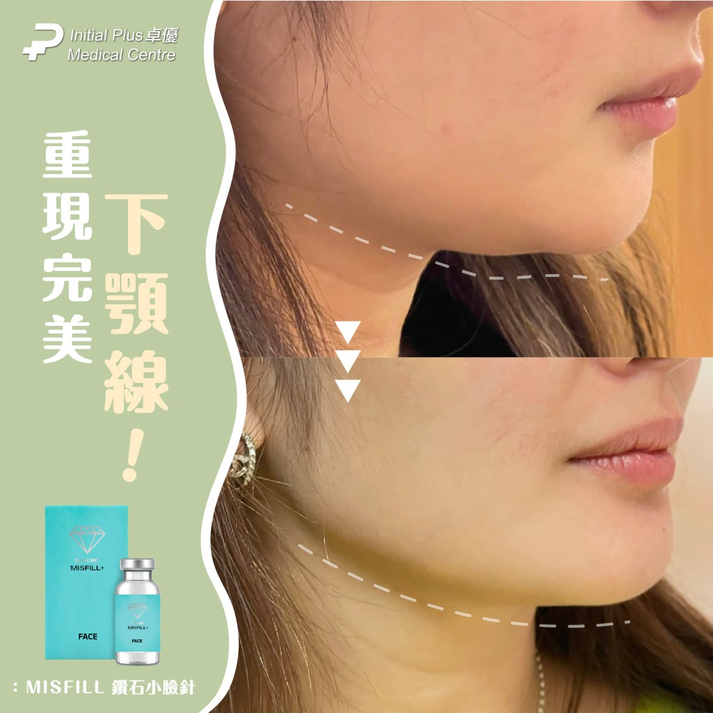 Initial Plus Medical Centre 卓優醫療診所 misfill face