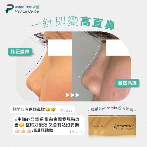 Neuramis 韓國透明質酸