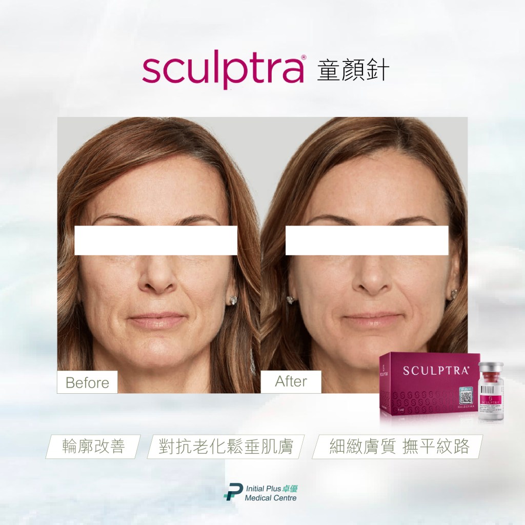 Initial Plus Medical Centre 卓優醫療診所 sculptra童顏針對比圖
