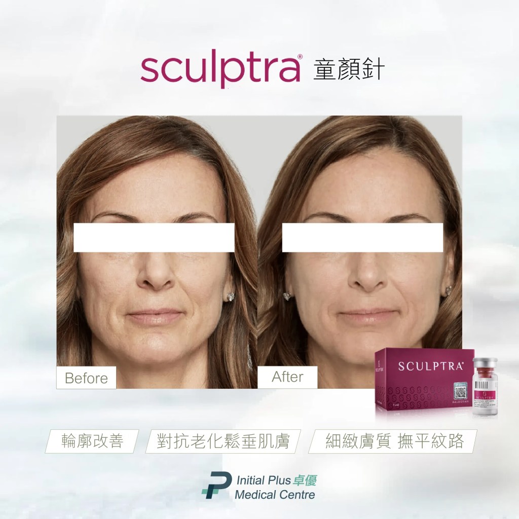 Initial Plus Medical Centre 卓優醫療診所 2025最新膠原自生填充全解析 sculptra童顏針