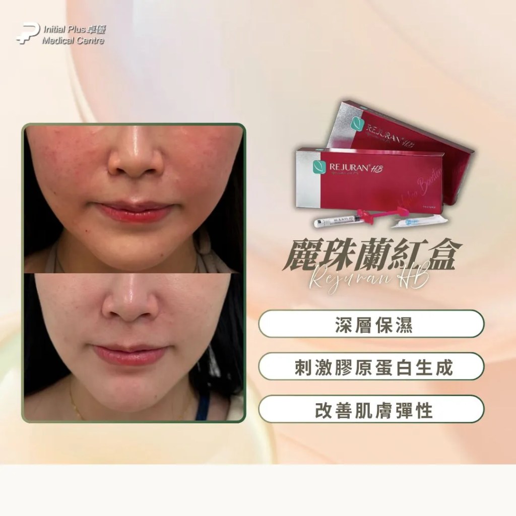 【Rejuran麗珠蘭4色懶人包】黑盒抗老、藍盒痘疤、白盒眼周、紅盒保濕一文看懂全解 11 Initial Plus Medical Centre 卓優醫療診所 Rejuran麗珠蘭4色懶人包b94fa2d1 fcd6 436c 8660 5f99cc157541