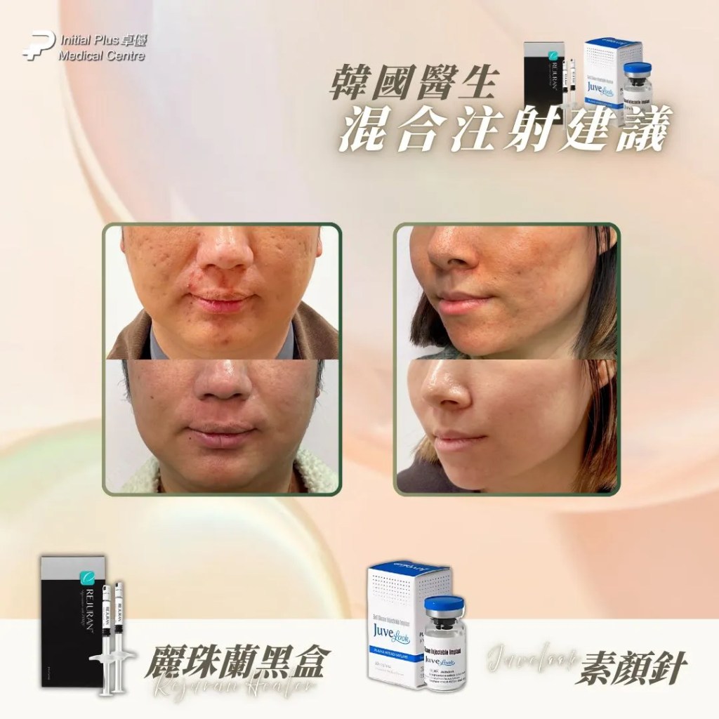 【Rejuran麗珠蘭4色懶人包】黑盒抗老、藍盒痘疤、白盒眼周、紅盒保濕一文看懂全解 12 Initial Plus Medical Centre 卓優醫療診所 Rejuran麗珠蘭4色懶人包d73ed735 84db 44c4 9d5f 64b9cc5e8a69