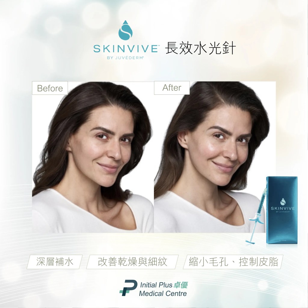 【水光針全攻略】麗珠蘭黑盒、Juvelook素顏針、冰冰針、Profhilo逆時針、Skinvive喬雅登昇光針、Misfill三文魚水光針,一文教你精準選擇最適合你肌膚的水光針 19 Initial Plus Medical Centre 卓優醫療診所 水光針全攻略skinvive BA