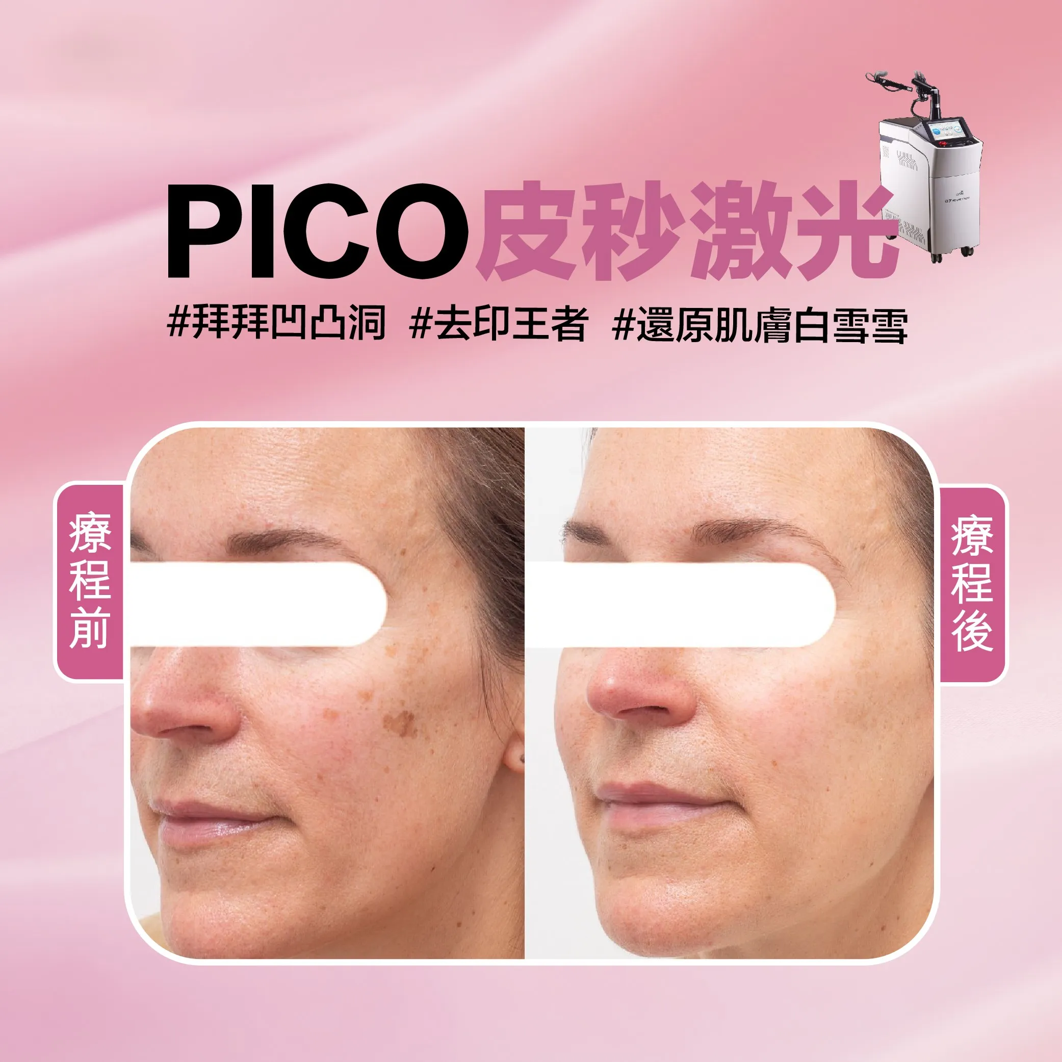 pico 2 工作區域 1 1
