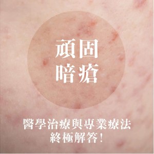 頑固暗瘡怎麼辦？醫學治療與專業療法的終極解答，教你如何打破痘痘惡性循環！cover